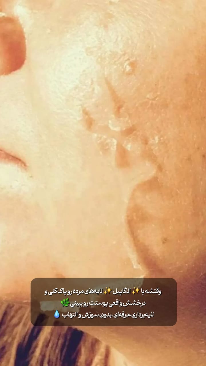 خدمات پاکسازی و درمان پوست یلدا اکبری در شیراز